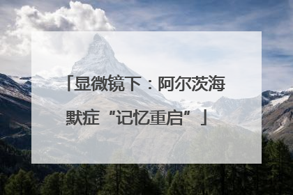 显微镜下：阿尔茨海默症“记忆重启”